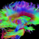 A wiring diagram of a human brain.